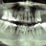 Curso de Implantologia Oral Galeria de imágenes